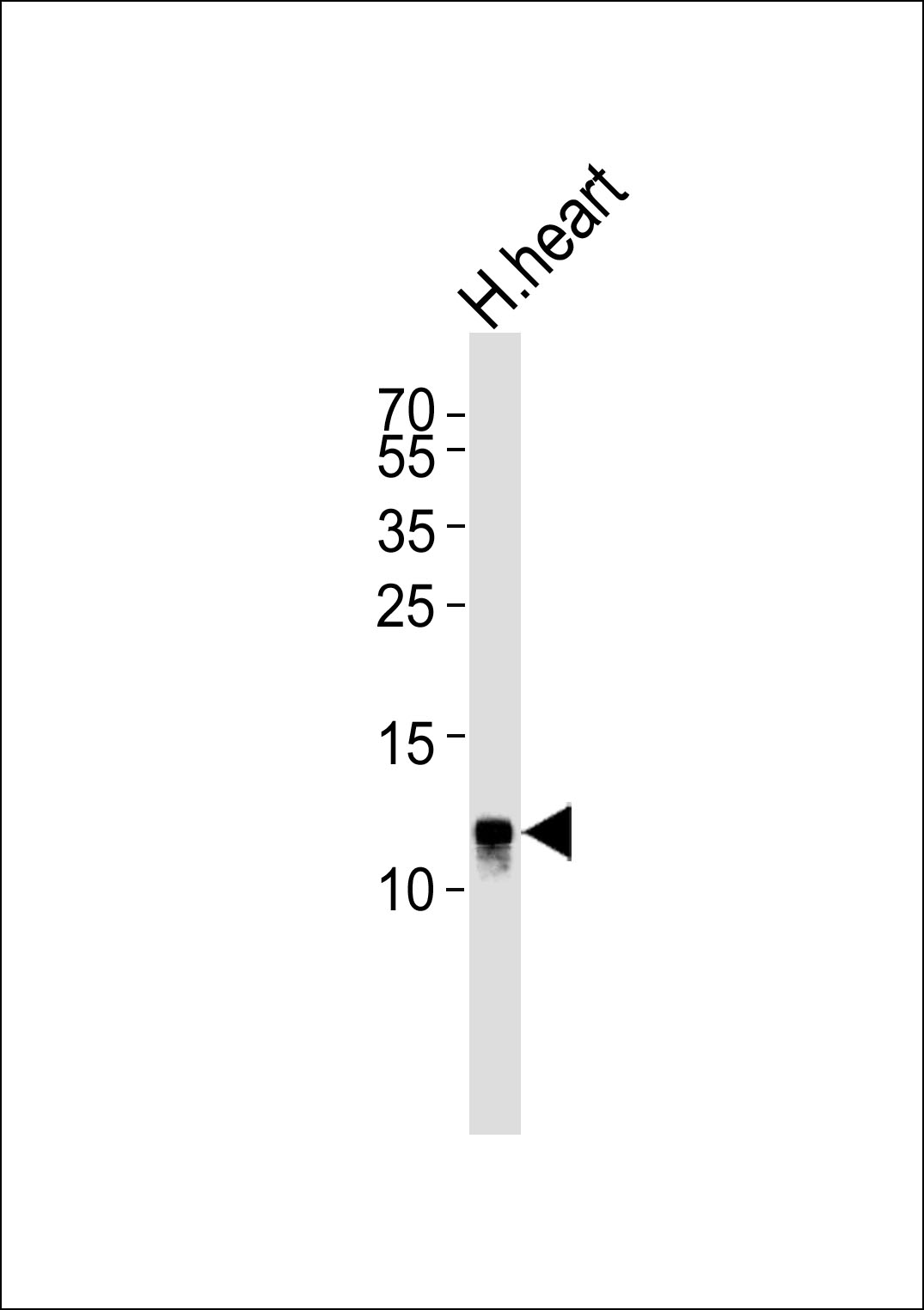 Western blot analysis of lysate from human heart tissue lysate, using NDUFV3 Antibody (C-term)(Cat. #AP20688c). AP20688c was diluted at 1:1000. A goat anti-rabbit IgG H&L(HRP) at 1:5000 dilution was used as the secondary antibody. Lysate at 35ug.