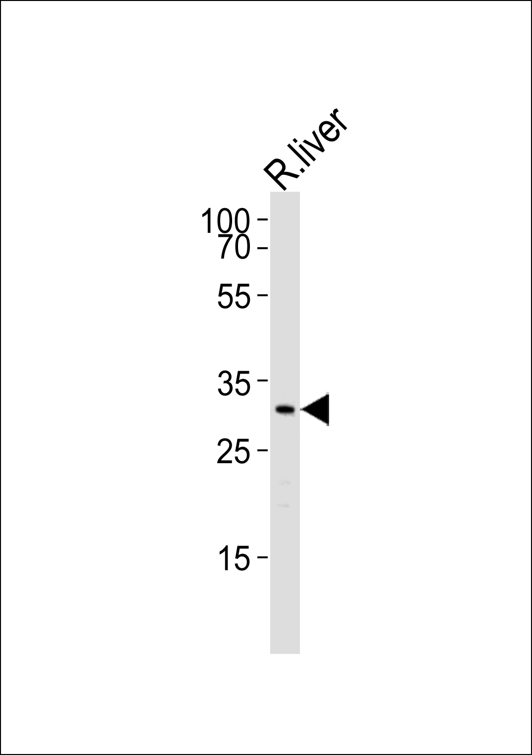 Western blot analysis of lysate from R. liver cell line, using rat-Cebpb-S105(Cat. #AP20701b). AP20701b was diluted at 1:1000. A goat anti-rabbit IgG H&L(HRP) at 1:5000 dilution was used as the secondary antibody. Lysate at 35ug.