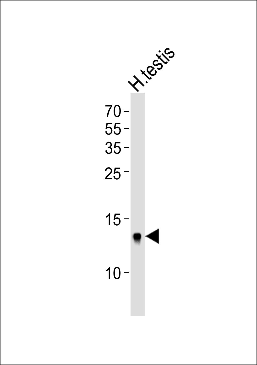 Western blot analysis of lysate from human testis tissue lysate, using DEFB107A Antibody (C-term)(Cat. #AP20656c). AP20656c was diluted at 1:1000. A goat anti-rabbit IgG H&L(HRP) at 1:5000 dilution was used as the secondary antibody. Lysate at 35ug.