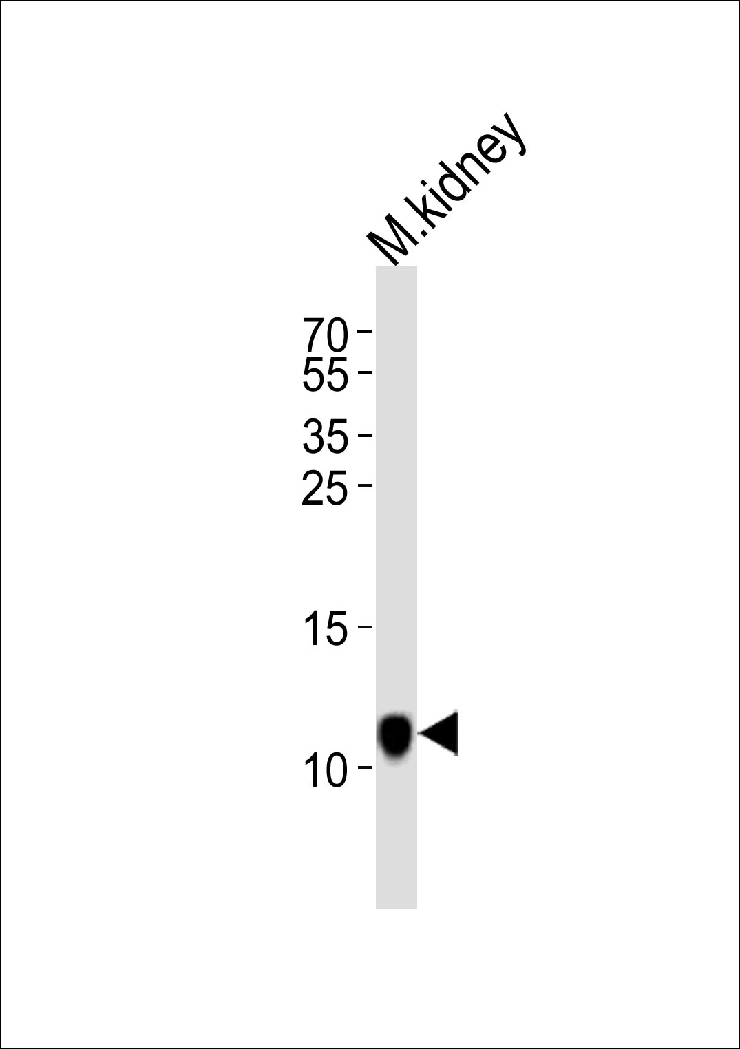 Western blot analysis of lysate from mouse kidney tissue lysate, using MINOS1 Antibody (N-term)(Cat. #AP20802a). AP20802a was diluted at 1:1000. A goat anti-rabbit IgG H&L(HRP) at 1:10000 dilution was used as the secondary antibody. Lysate at 35ug.