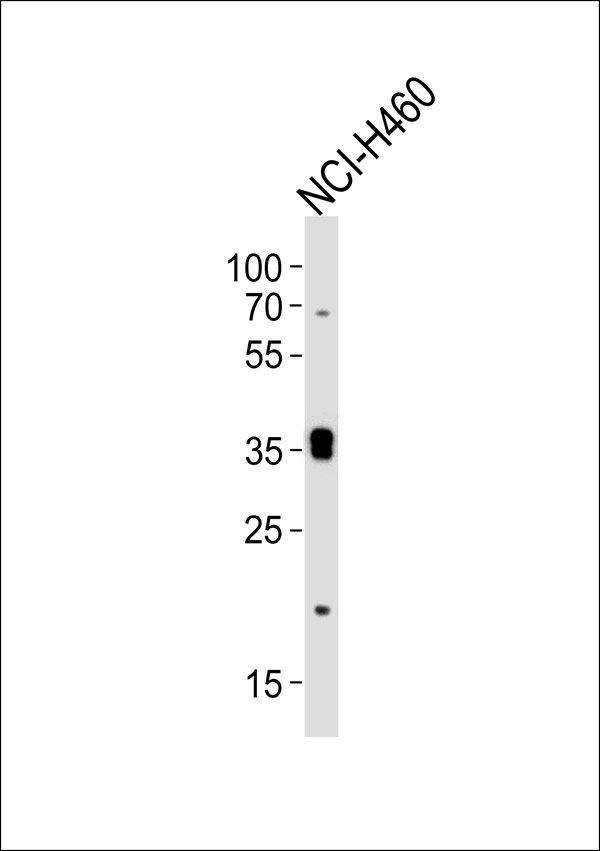 Western blot analysis of lysate from NCI-H460 cell line,using SLC39A1 Antibody, was diluted at 1:1000. A goat anti-rabbit IgG H&L(HRP) at 1:5000 dilution was used as the secondary antibody.Lysate at 35ug.