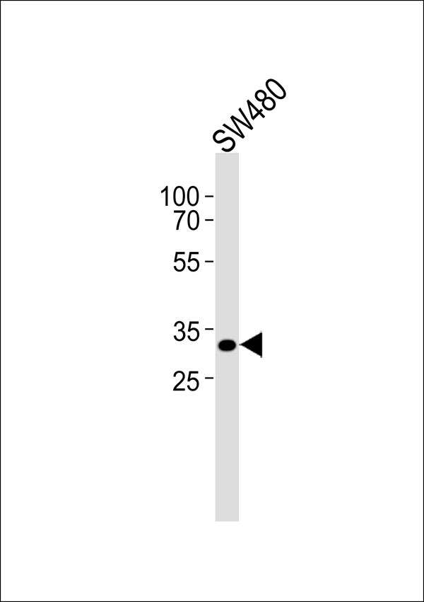Western blot analysis of lysate from SW480 cell line,using CEP76 Antibody, was diluted at 1:1000. A goat anti-rabbit IgG H&L(HRP) at 1:5000 dilution was used as the secondary antibody.Lysate at 35ug.