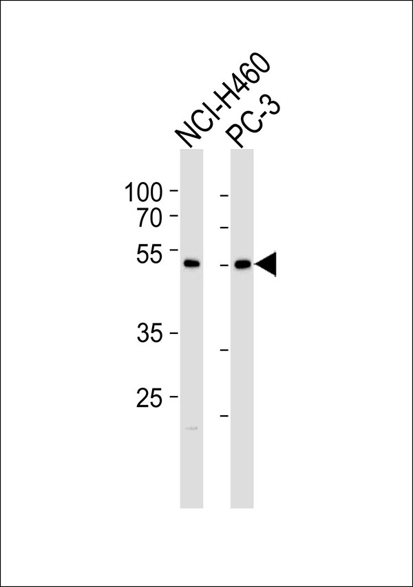 Western blot analysis of lysates from NCI-H460,PC-3 cell line (from left to right),using SLC39A9 Antibody, was diluted at 1:1000 at each lane. A goat anti-rabbit IgG H&L(HRP) at 1:5000 dilution was used as the secondary antibody.Lysates at 35ug per lane.