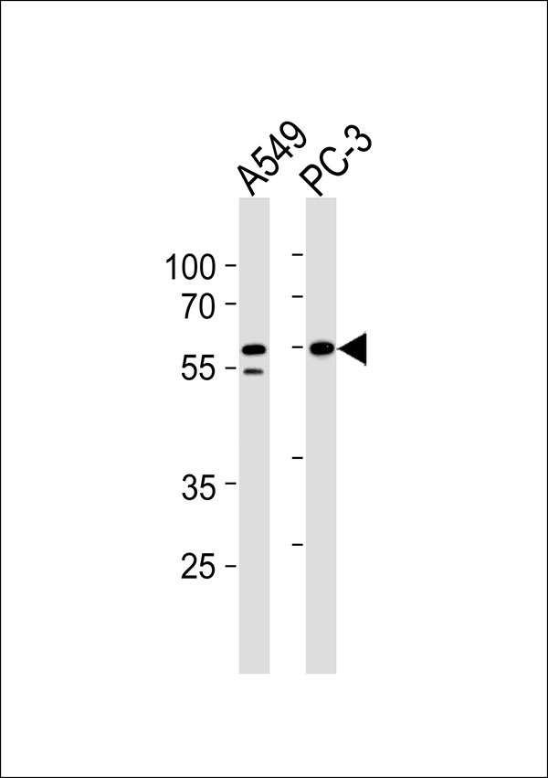Western blot analysis of lysates from A549,PC-3 cell line (from left to right),using RSAD1 Antibody, was diluted at 1:1000 at each lane. A goat anti-rabbit IgG H&L(HRP) at 1:5000 dilution was used as the secondary antibody.Lysates at 35ug per lane.