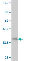 Antibody Reactive Against Recombinant Protein.Western Blot detection against Immunogen (35.53 KDa) .