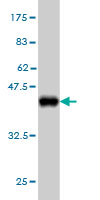 Antibody Reactive Against Recombinant Protein.Western Blot detection against Immunogen (37.73 KDa) . 