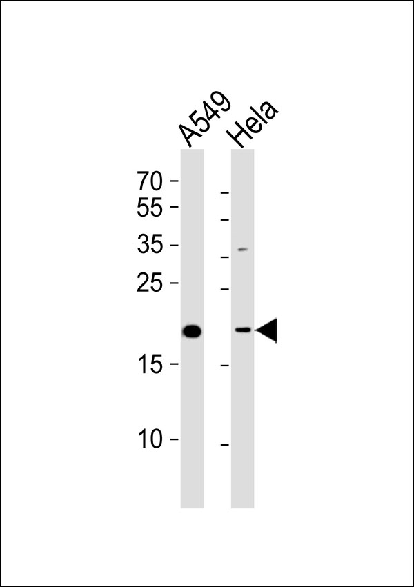 Western blot analysis of lysates from A549,Hela cell line (from left to right),using ATP5L2 Antibody. This antibody was diluted at 1:1000 at each lane. A goat anti-rabbit IgG H&L(HRP) at 1:5000 dilution was used as the secondary antibody.Lysates at 35ug per lane.