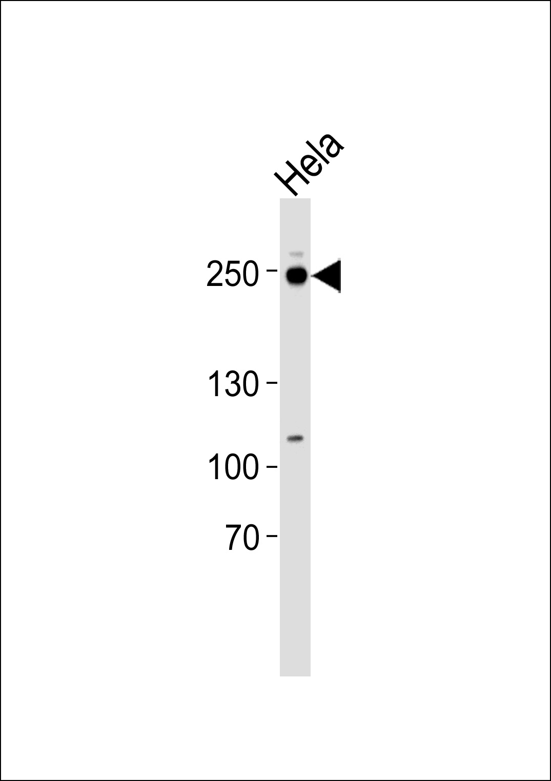 Western blot analysis of lysate from Hela cell line, using RSF1 Antibody (C-term)(Cat. #AP20734c). AP20734c was diluted at 1:1000. A goat anti-rabbit IgG H&L(HRP) at 1:5000 dilution was used as the secondary antibody. Lysate at 35ug.