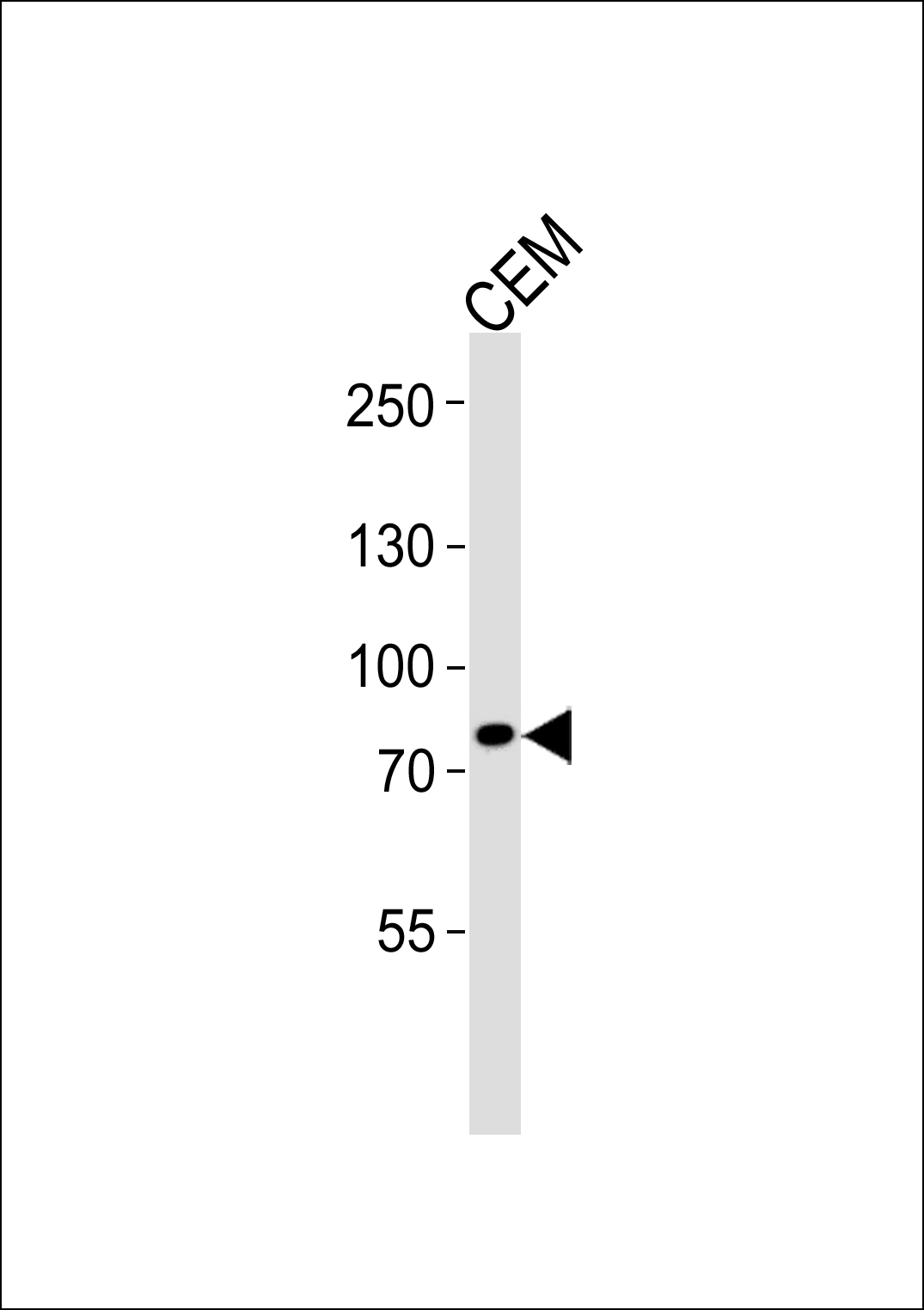 Western blot analysis of lysate from CEM cell line, using ACAP3 Antibody (C-term)(Cat. #AP20717c). AP20717c was diluted at 1:1000. A goat anti-rabbit IgG H&L(HRP) at 1:5000 dilution was used as the secondary antibody. Lysate at 35ug.