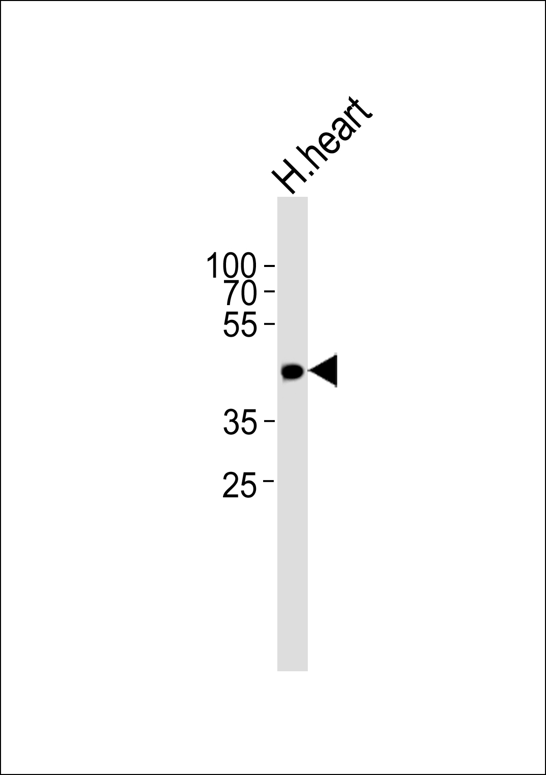 Western blot analysis of lysate from human heart tissue lysate, using OR13C9 Antibody (N-term)(Cat. #AP20733a). AP20733a was diluted at 1:1000. A goat anti-rabbit IgG H&L(HRP) at 1:5000 dilution was used as the secondary antibody. Lysate at 35ug.
