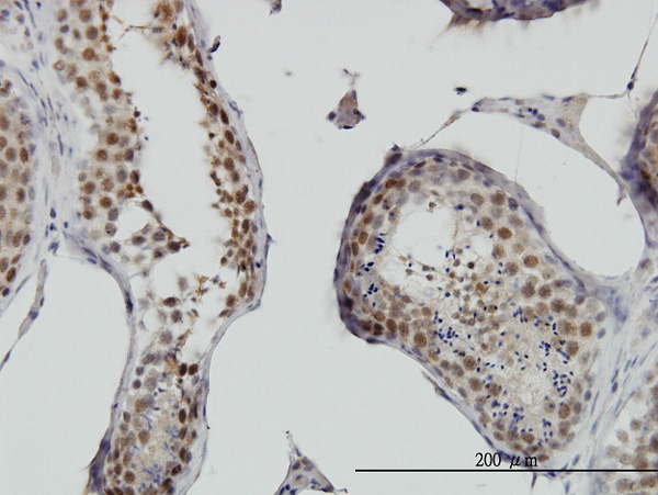 Immunoperoxidase of monoclonal antibody to RNF141 on formalin-fixed paraffin-embedded human testis. [antibody concentration 0.3 ug/ml]