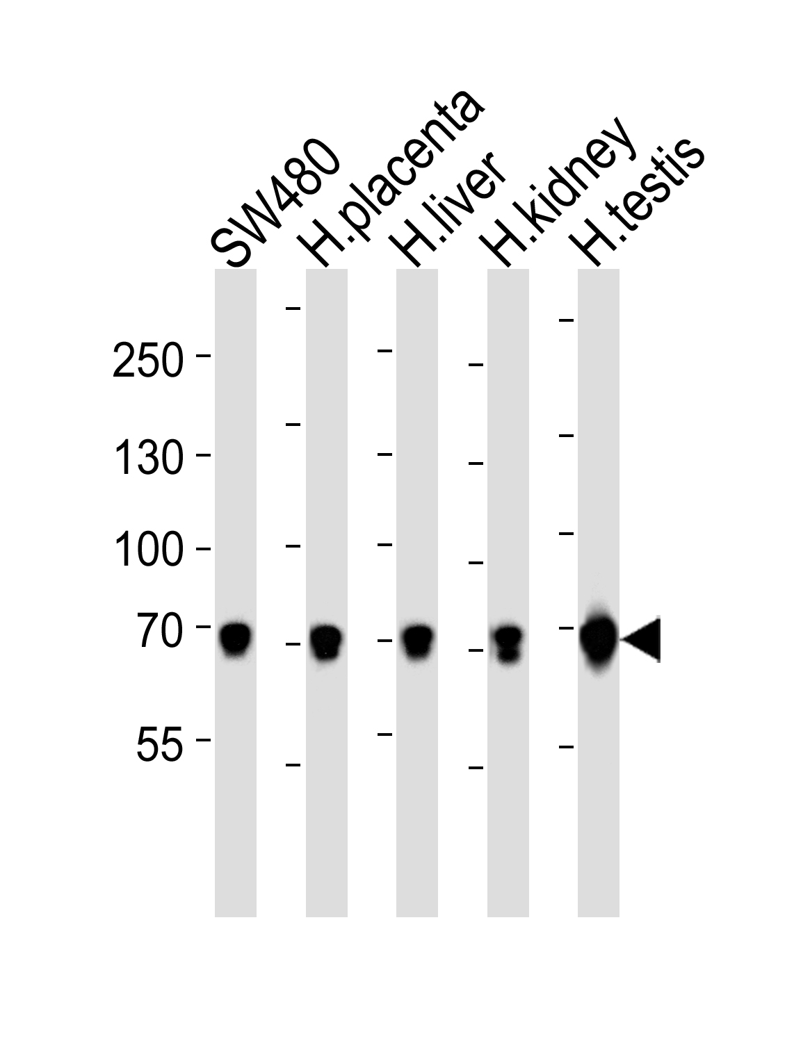 Western blot analysis of lysates from SW480 cell line, human placenta, huamn liver, kidney and testis tissue lysate(from left to right), using TRPV6 Antibody (Center)(Cat. #AP20671c). AP20671c was diluted at 1:1000 at each lane. A goat anti-rabbit IgG H&L(HRP) at 1:5000 dilution was used as the secondary antibody. Lysates at 35ug per lane.