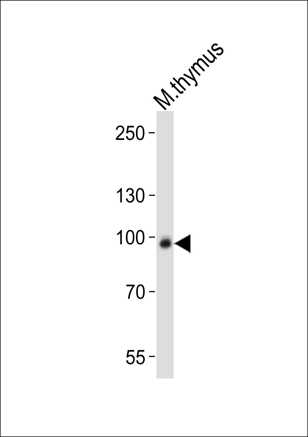 Western blot analysis of lysate from mouse thymus tissue lysate, using Rps6ka5 Antibody (C-term)(Cat. #AP20900c). AP20900c was diluted at 1:1000. A goat anti-rabbit IgG H&L(HRP) at 1:10000 dilution was used as the secondary antibody. Lysate at 20ug.
