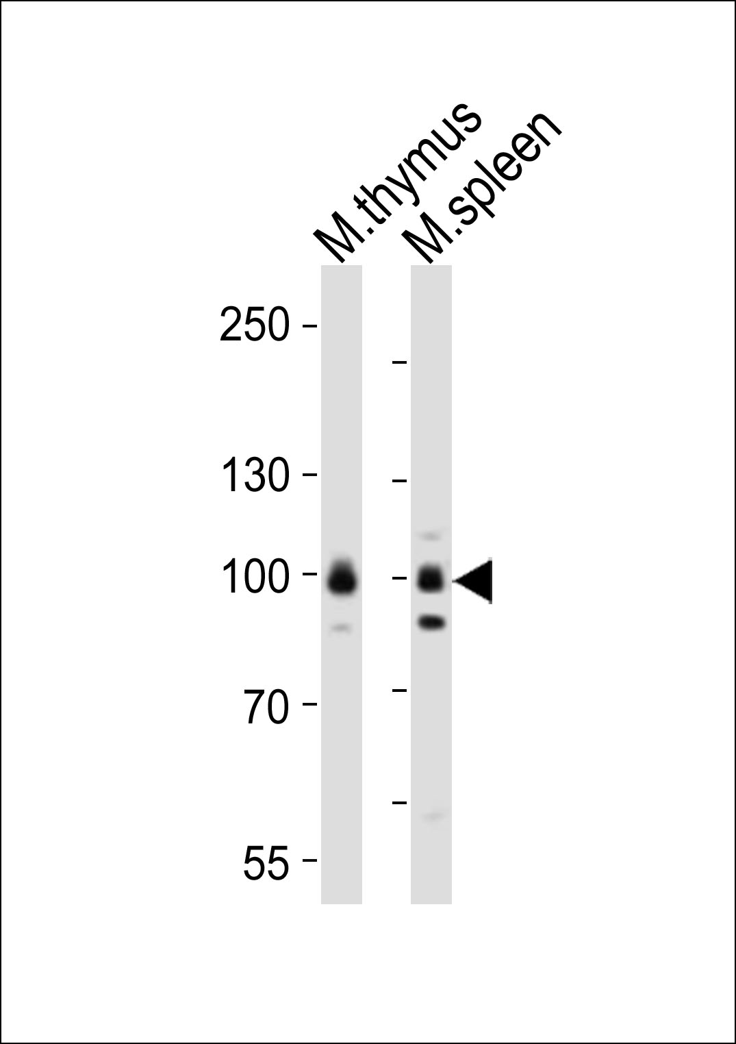 Western blot analysis of lysates from mouse thymus, mouse spleen tissue lysate (from left to right), using Rps6ka5 Antibody (C-term)(Cat. #AP20901c). AP20901c was diluted at 1:1000 at each lane. A goat anti-rabbit IgG H&L(HRP) at 1:10000 dilution was used as the secondary antibody. Lysates at 20ug per lane.