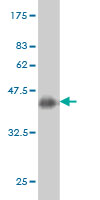 Antibody Reactive Against Recombinant Protein.Western Blot detection against Immunogen (36.63 KDa) . 