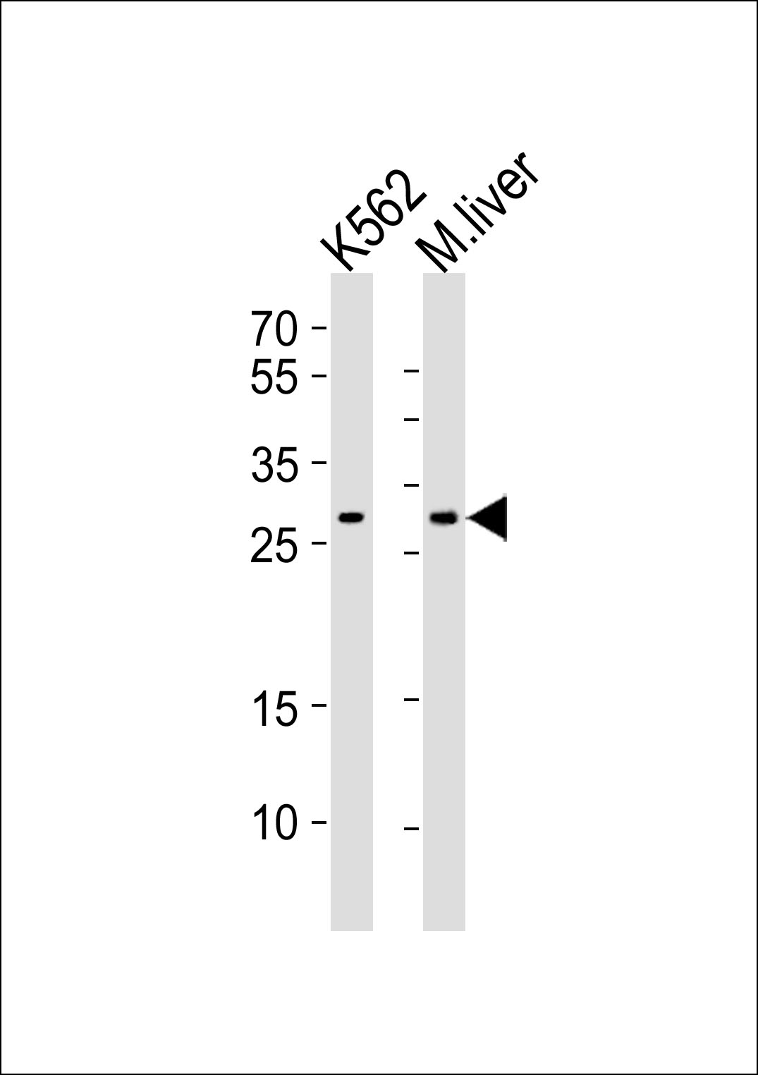 Western blot analysis of lysates from K562 cell line, mouse liver tissue lysate (from left to right), using CYB5R2 Antibody (N-term)(Cat. #AP20834a). AP20834a was diluted at 1:1000 at each lane. A goat anti-rabbit IgG H&L(HRP) at 1:10000 dilution was used as the secondary antibody. Lysates at 35ug per lane.