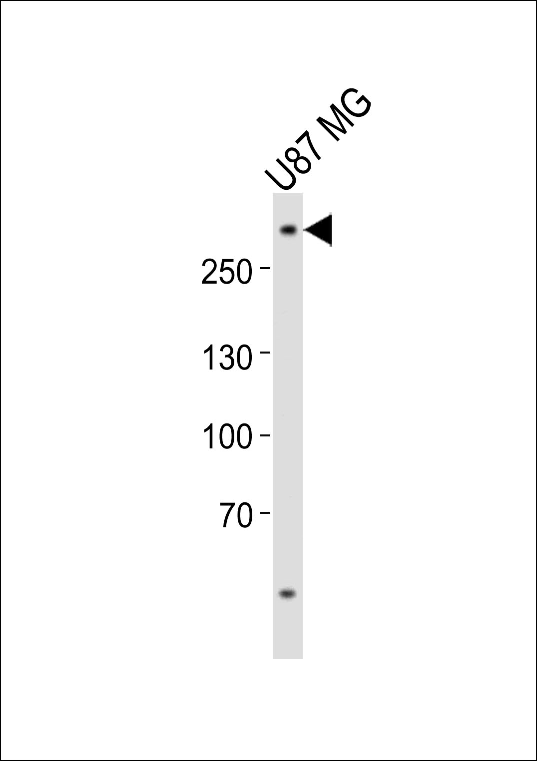 Western blot analysis of lysate from U-87 MG cell line, using ABCA2 Antibody (Center)(Cat. #AP21066a). AP21066a was diluted at 1:1000. A goat anti-rabbit IgG H&L(HRP) at 1:10000 dilution was used as the secondary antibody. Lysate at 20ug.