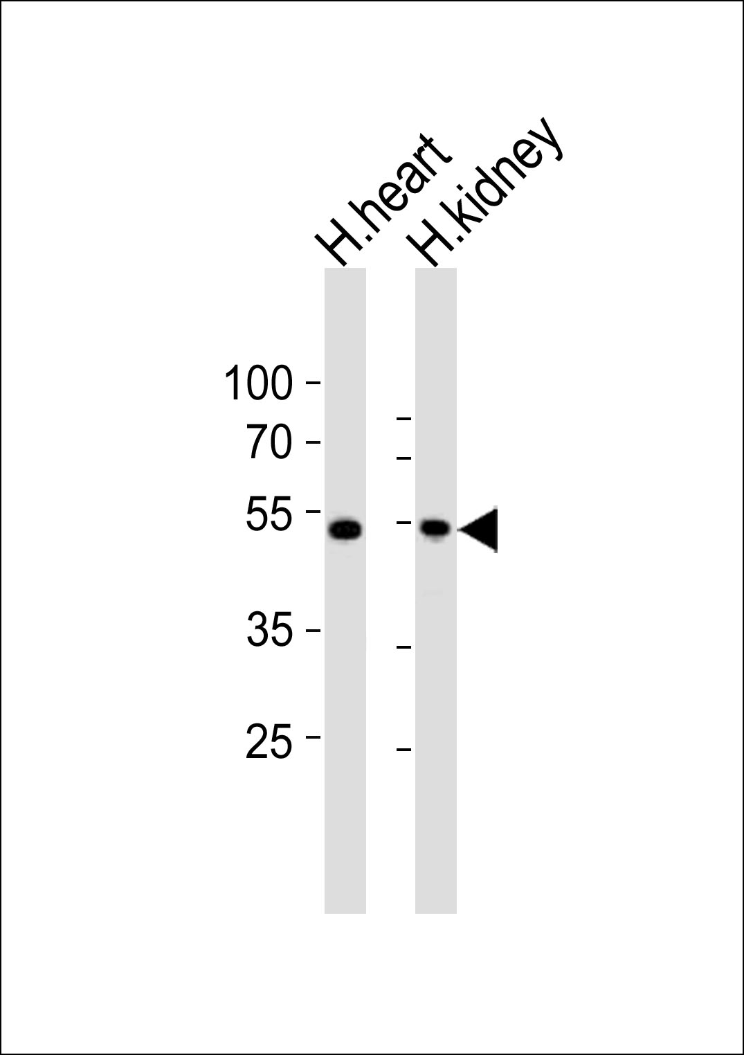 Western blot analysis of lysates from human heart and human kidney tissue (from left to right), using ST3GAL2 Antibody (Nterm)(Cat. #AP21060a). AP21060a was diluted at 1:1000 at each lane. A goat anti-rabbit IgG H&L(HRP) at 1:10000 dilution was used as the secondary antibody. Lysates at 20ug per lane.
