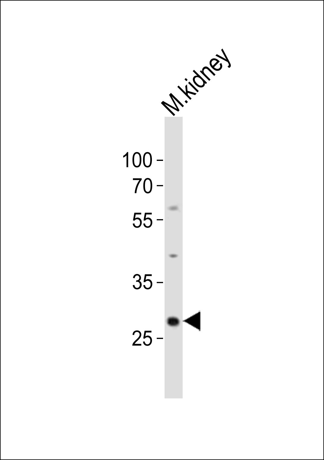 Western blot analysis of lysate from mouse kidney tissue lysate, using Hes1 Antibody (C-term)(Cat. #AP21019c). AP21019c was diluted at 1:500. A goat anti-rabbit IgG H&L(HRP) at 1:10000 dilution was used as the secondary antibody. Lysate at 20ug.