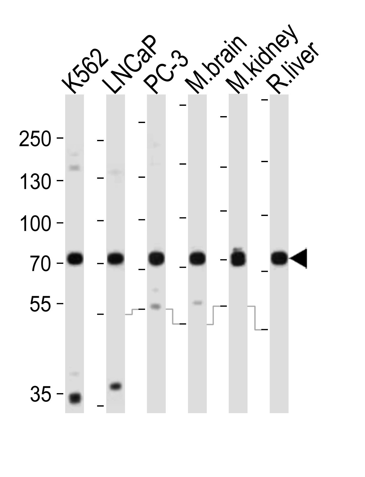 Western blot analysis of lysates from K562, LNCaP, PC-3 cell line, mouse brain, mouse kidney, rat liver tissue lysate (from left to right), using CD164 Antibody (C-term)(Cat. #AP21047a). AP21047a was diluted at 1:1000 at each lane. A goat anti-rabbit IgG H&L(HRP) at 1:10000 dilution was used as the secondary antibody. Lysates at 20ug per lane.