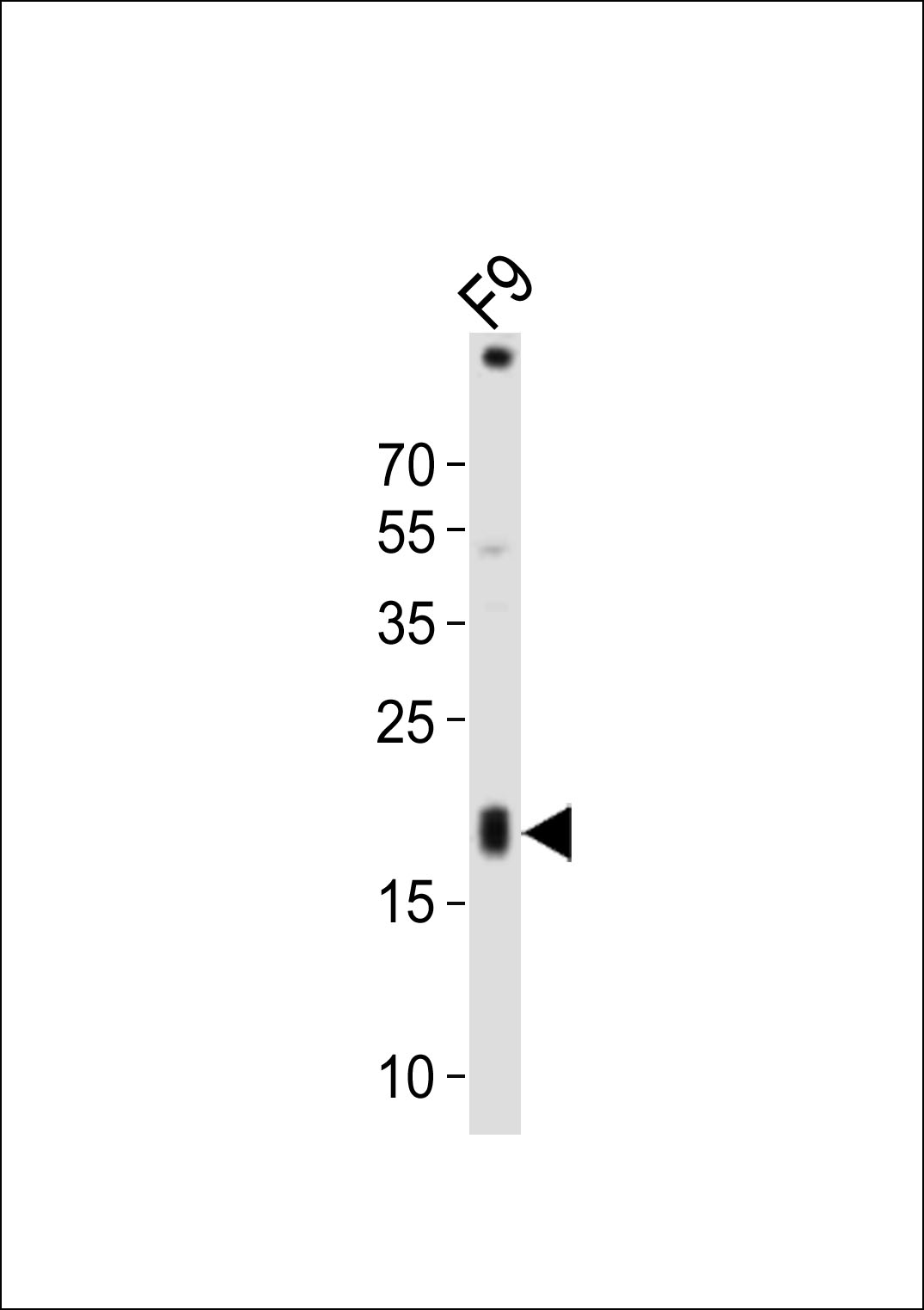 Western blot analysis of lysate from mouse F9 cell line, using Tdgf1 Antibody (N-term)(Cat. #AP21046a). AP21046a was diluted at 1:1000. A goat anti-rabbit IgG H&L(HRP) at 1:10000 dilution was used as the secondary antibody. Lysate at 20ug.