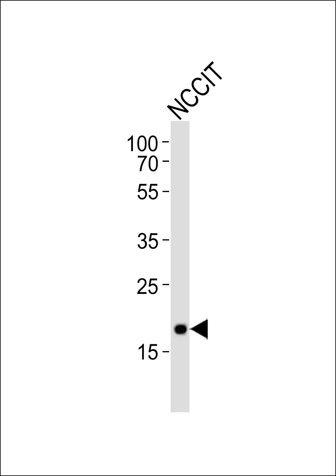Western blot analysis of lysate from NCCIT cell line, using Mouse Hmga2 Antibody (N-term)(Cat. #AP21032a). AP21032a was diluted at 1:1000. A goat anti-rabbit IgG H&L(HRP) at 1:10000 dilution was used as the secondary antibody. Lysate at 20ug.