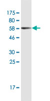 Antibody Reactive Against Recombinant Protein.Western Blot detection against Immunogen (61.6 KDa) . 