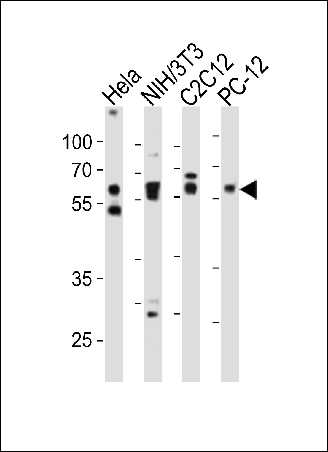 Western blot analysis of lysates from Hela, mouse NIH/3T3, mouse C2C12, rat PC-12 cell line (from left to right), using Smad2 Antibody (Center)(Cat. #AP21006a). AP21006a was diluted at 1:1000 at each lane. A goat anti-rabbit IgG H&L(HRP) at 1:10000 dilution was used as the secondary antibody. Lysates at 20ug per lane.
