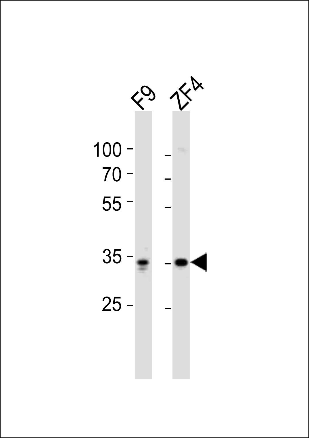 Western blot analysis of lysates from mouse F9, Zebrafish ZF4 cell line (from left to right), using WDR82 Antibody (N-term)(Cat. #AP20977b). AP20977b was diluted at 1:1000 at each lane. A goat anti-rabbit IgG H&L(HRP) at 1:10000 dilution was used as the secondary antibody. Lysates at 20ug per lane.