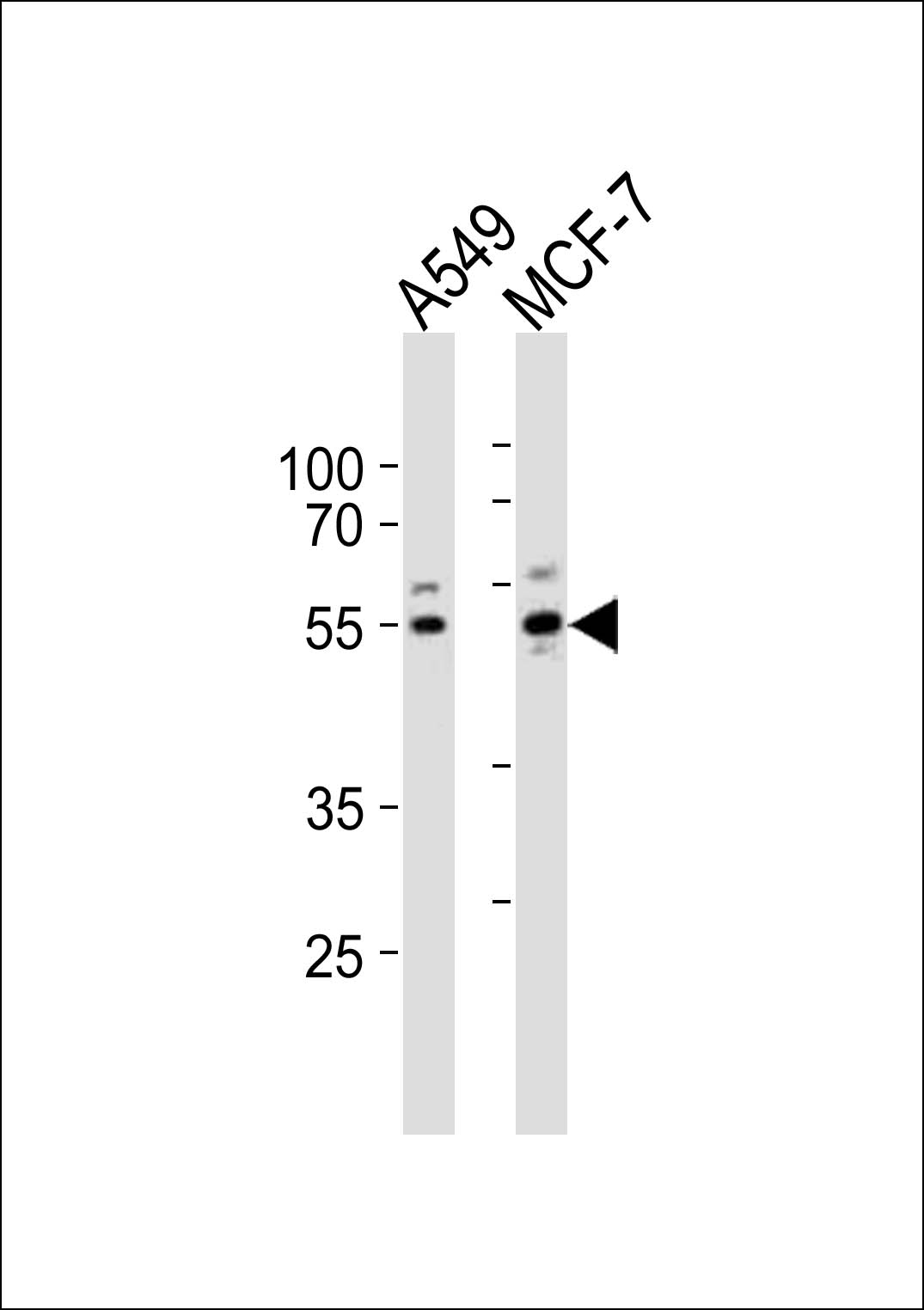 Western blot analysis of lysates from A549, MCF-7 cell line (from left to right), using PPP2R2C Antibody (N-term)(Cat. #AP20956b). AP20956b was diluted at 1:1000 at each lane. A goat anti-rabbit IgG H&L(HRP) at 1:10000 dilution was used as the secondary antibody. Lysates at 20ug per lane.