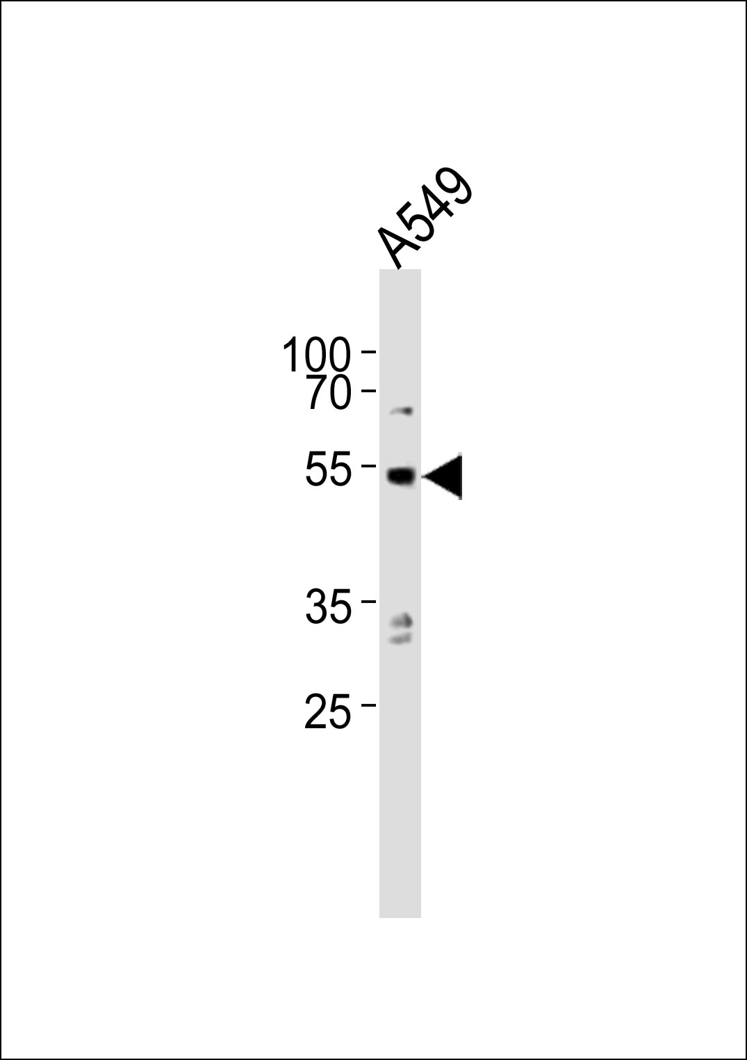 Western blot analysis of lysate from A549 cell line, using PPP2R2C Antibody (Center)(Cat. #AP20942a). AP20942a was diluted at 1:1000. A goat anti-rabbit IgG H&L(HRP) at 1:10000 dilution was used as the secondary antibody. Lysate at 20ug.