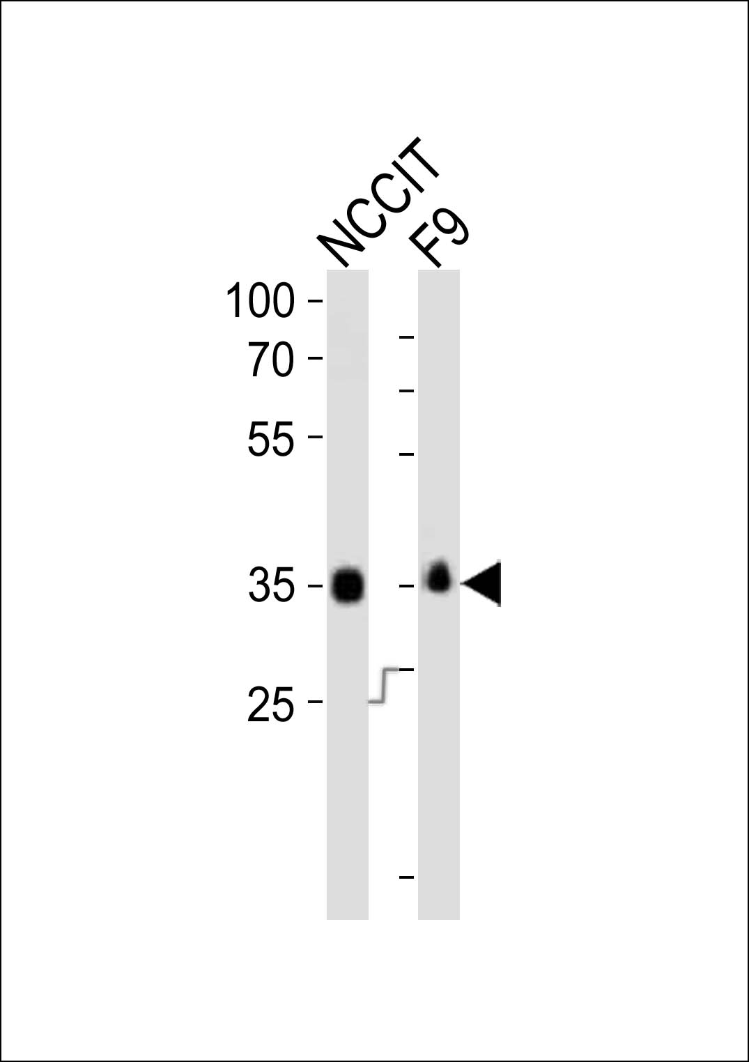 Western blot analysis of lysates from NCCIT, mouse F9 cell line (from left to right), using Sox2 Antibody (N-term)(Cat. #AP20939b). AP20939b was diluted at 1:1000 at each lane. A goat anti-rabbit IgG H&L(HRP) at 1:10000 dilution was used as the secondary antibody. Lysates at 20ug per lane.