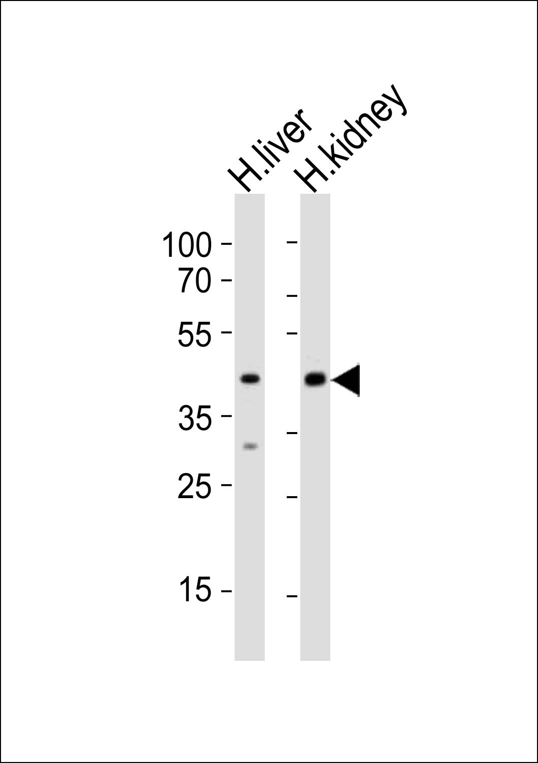 Western blot analysis of lysates from human liver, human kidney tissue (from left to right), using POU5F1B Antibody (C-term)(Cat. #AP20933c). AP20933c was diluted at 1:1000 at each lane. A goat anti-rabbit IgG H&L(HRP) at 1:10000 dilution was used as the secondary antibody. Lysates at 20ug per lane.