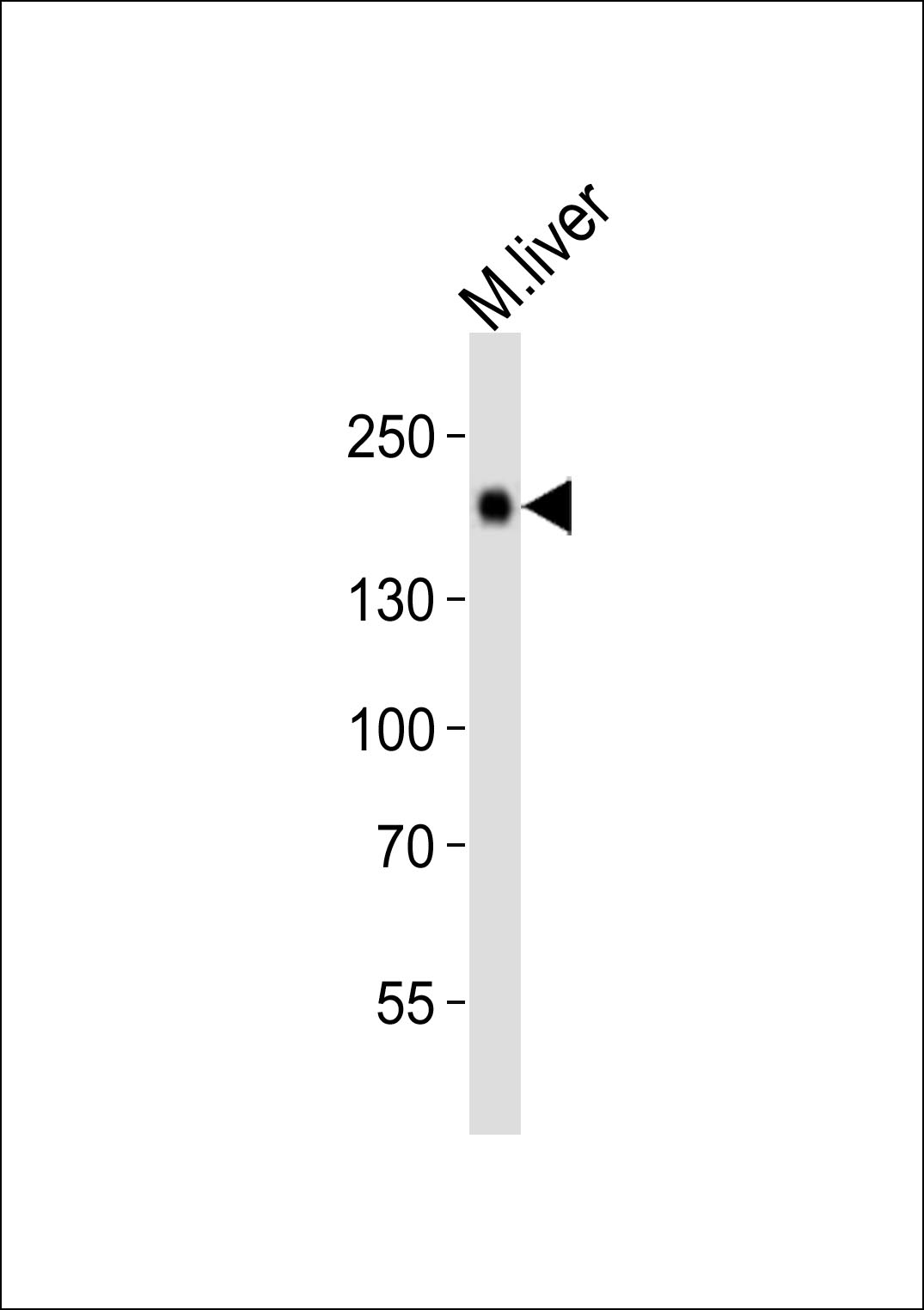 Western blot analysis of lysate from mouse liver tissue, using Egfr Antibody (P1116)(Cat. #AP20926a). AP20926a was diluted at 1:1000. A goat anti-rabbit IgG H&L(HRP) at 1:10000 dilution was used as the secondary antibody. Lysate at 20ug.