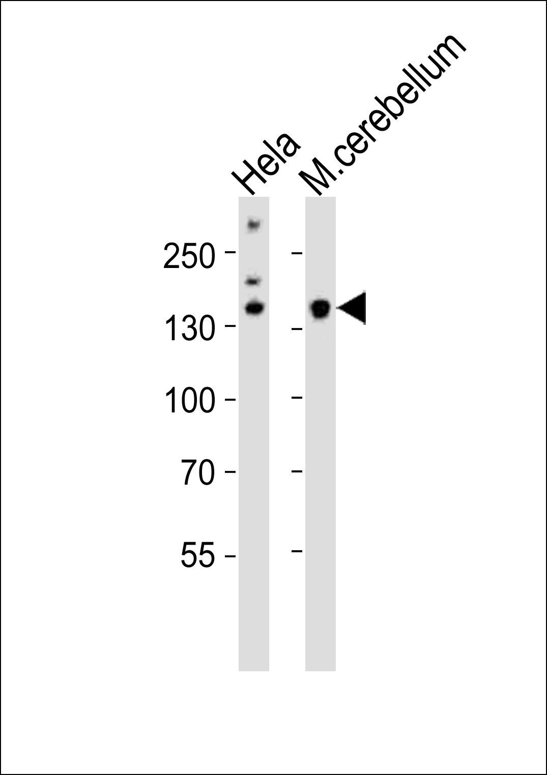 Western blot analysis of lysates from Hela cell line, mouse cerebellum tissue (from left to right), using Mouse Kdm6b Antibody (Center)(Cat. #AP20854c). AP20854c was diluted at 1:1000 at each lane. A goat anti-rabbit IgG H&L(HRP) at 1:10000 dilution was used as the secondary antibody. Lysates at 20ug per lane.