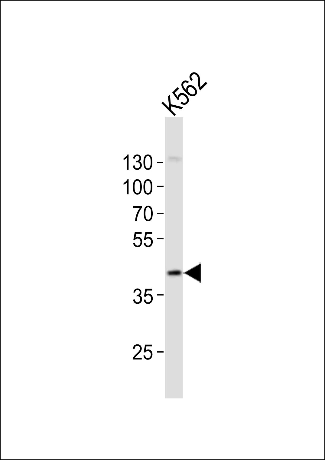 Western blot analysis of lysate from K562 cell line, using CHST11 Antibody (Center)(Cat. #AP21059a). AP21059a was diluted at 1:1000. A goat anti-rabbit IgG H&L(HRP) at 1:10000 dilution was used as the secondary antibody. Lysate at 20ug.