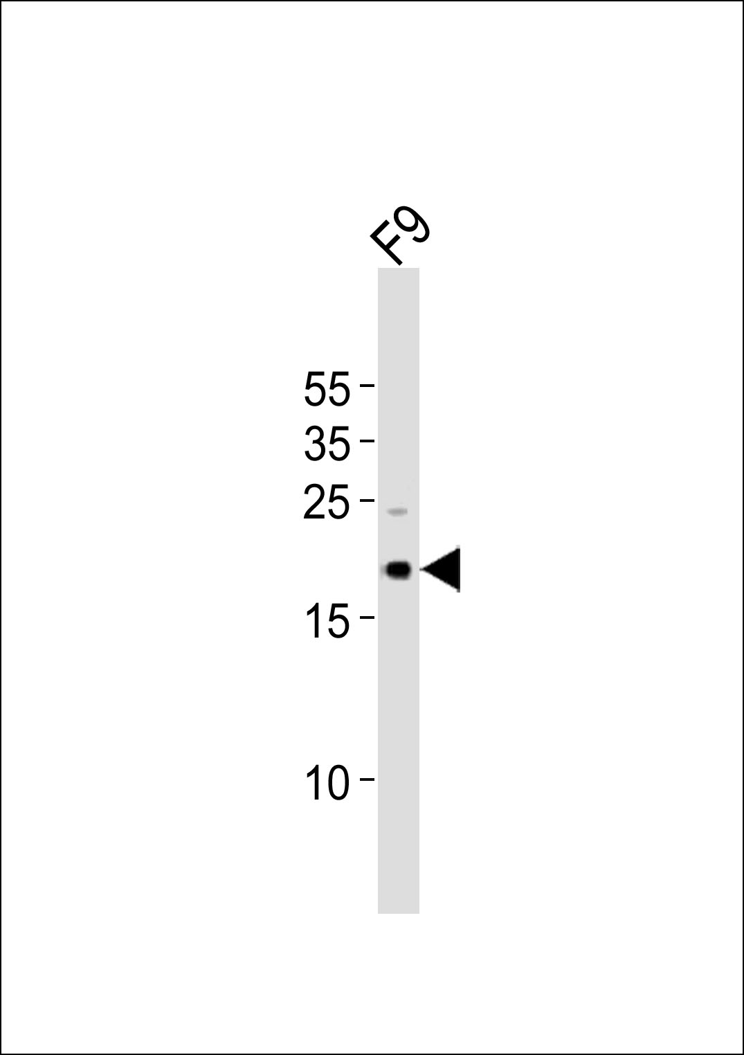 Western blot analysis of lysate from mouse F9 cell line, using (Mouse) Tdgf1 Antibody (N-term)(Cat. #AP21040a). AP21040a was diluted at 1:1000. A goat anti-rabbit IgG H&L(HRP) at 1:10000 dilution was used as the secondary antibody. Lysate at 20ug.