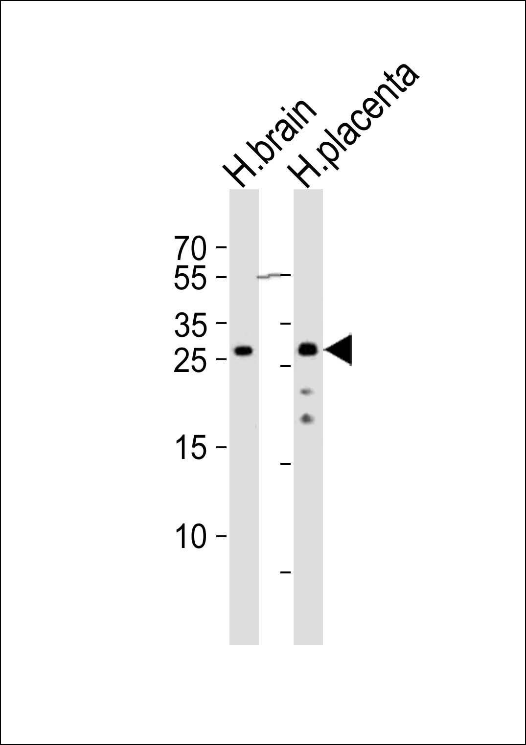 Western blot analysis of lysates from human brain and human placenta tissue (from left to right), using CHMP4A Antibody (C-term)(Cat. #AP21067a). AP21067a was diluted at 1:1000 at each lane. A goat anti-rabbit IgG H&L(HRP) at 1:10000 dilution was used as the secondary antibody. Lysates at 20ug per lane.