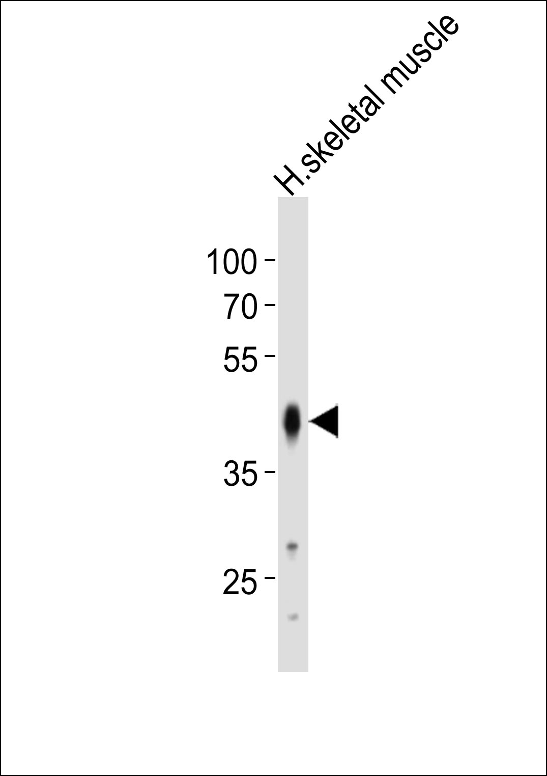 Western blot analysis of lysate from human skeletal muscle tissue lysate, using POU5F1B Antibody (N-term)(Cat. #AP21021a). AP21021a was diluted at 1:500. A goat anti-rabbit IgG H&L(HRP) at 1:10000 dilution was used as the secondary antibody. Lysate at 20ug.