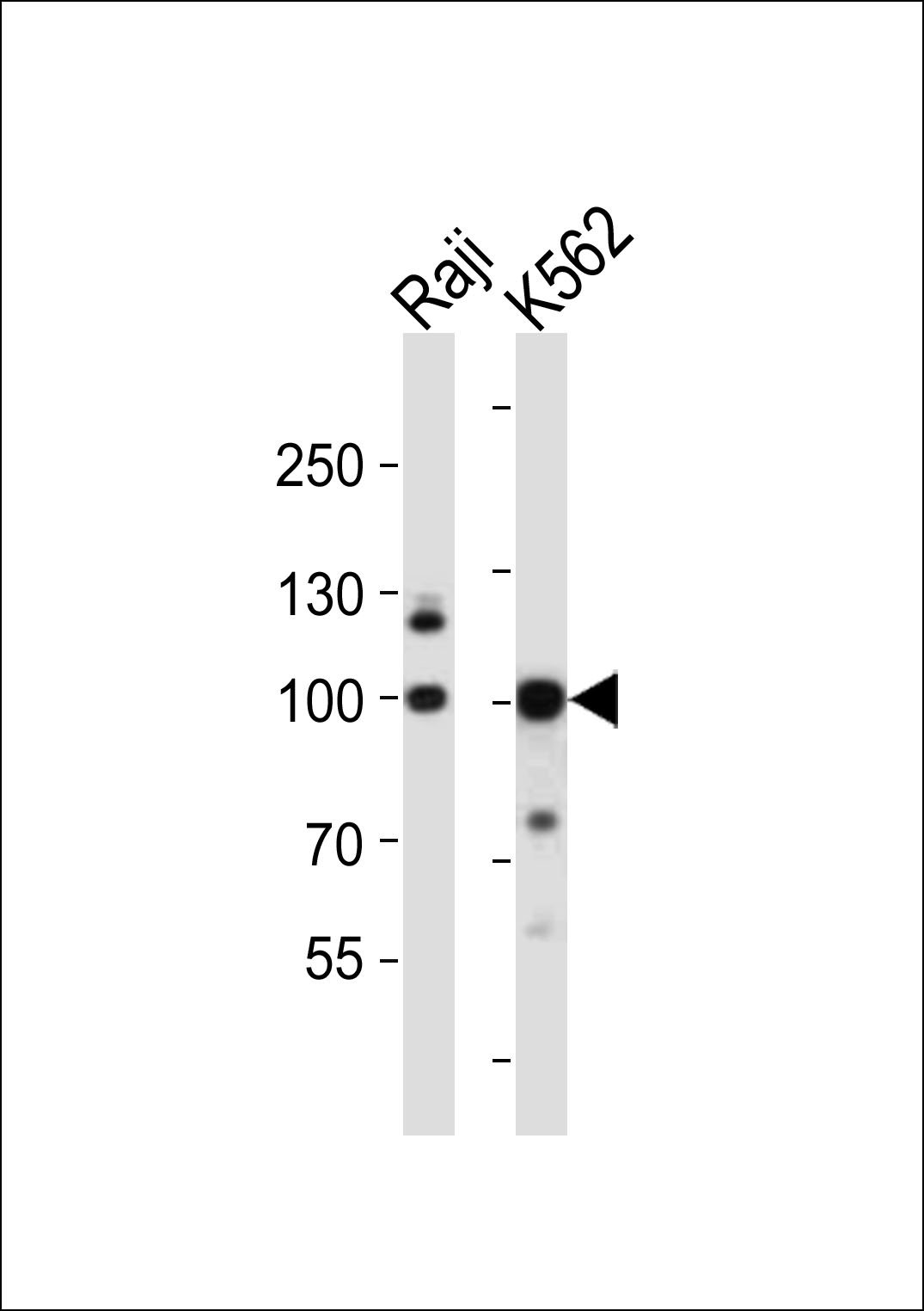 Western blot analysis of lysates from Raji, K562 cell line (from left to right), using KDM1B Antibody (N-term)(Cat. #AP21020a). AP21020a was diluted at 1:1000 at each lane. A goat anti-rabbit IgG H&L(HRP) at 1:10000 dilution was used as the secondary antibody. Lysates at 20ug per lane.