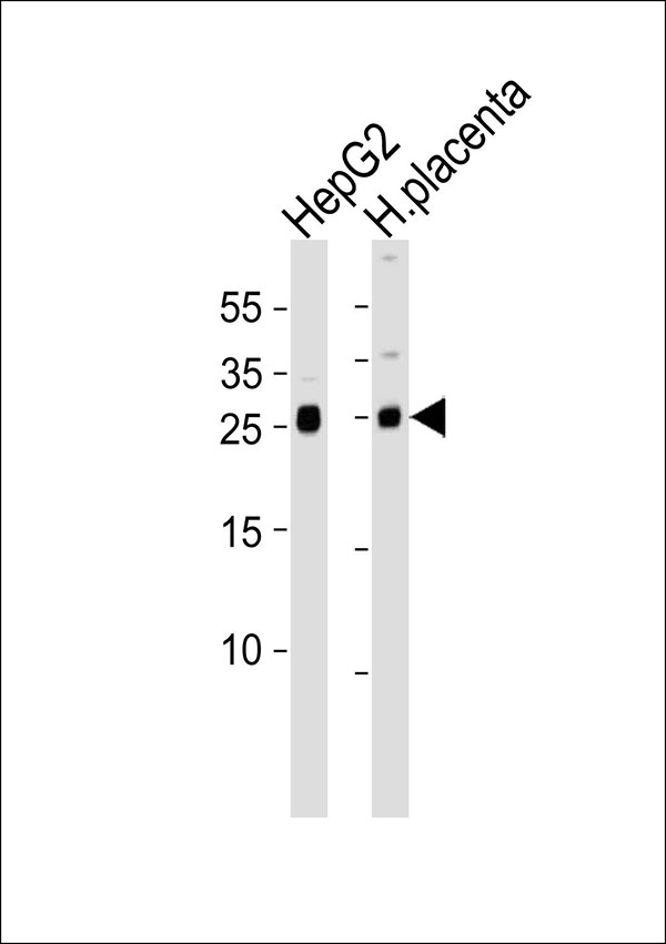 Western blot analysis of lysates from HepG2 cell line and human placenta tissue(from left to right), using Anti-FSTL3 antibody (bs-16188R). bs-16188R was diluted at 1:1000 at each lane. A goat anti-rabbit IgG H&L(HRP) at 1:10000 dilution was used as the secondary antibody.Lysates at 20ug per lane.