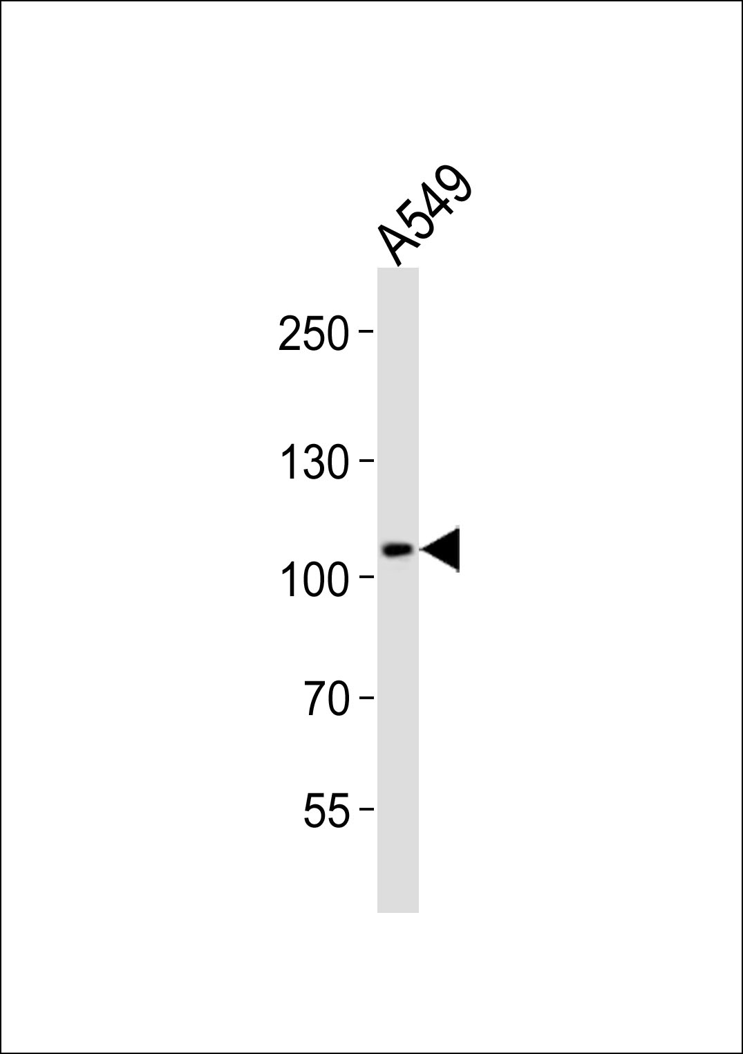 Western blot analysis of lysate from A549 cell line, using COG1 Antibody (C-term)(Cat. #AP21124a). AP21124a was diluted at 1:1000. A goat anti-rabbit IgG H&L(HRP) at 1:10000 dilution was used as the secondary antibody. Lysate at 20ug.