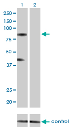 Western blot analysis of RNF103 over-expressed 293 cell line, cotransfected with RNF103 Validated Chimera RNAi ( (Cat # AT3656a )