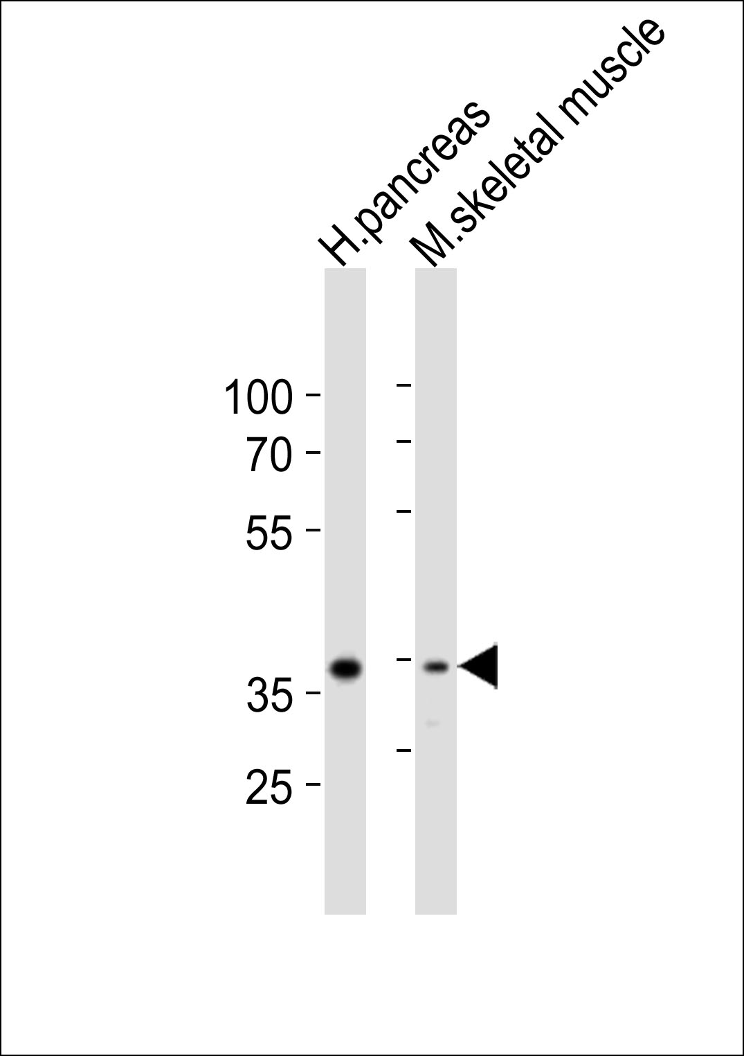 Western blot analysis of lysates from human pancreas, mouse skeletal muscle tissue lysate (from left to right), using B4GALT7 Antibody (C-term)(Cat. #AP21133a). AP21133a was diluted at 1:2000 at each lane. A goat anti-rabbit IgG H&L(HRP) at 1:10000 dilution was used as the secondary antibody. Lysates at 20ug per lane.