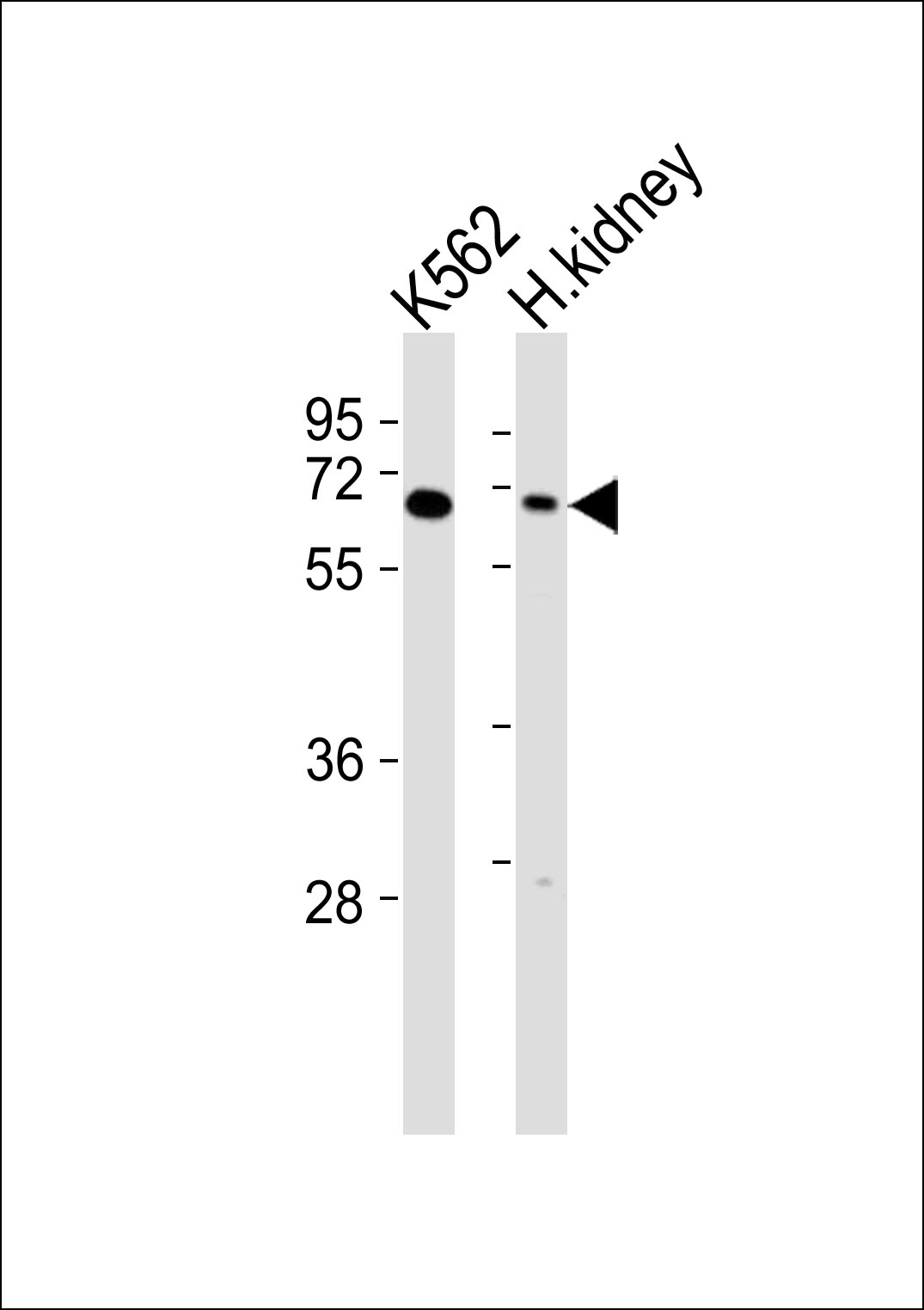 All lanes : Anti-Arylsulfatase D Antibody at 1:1000 dilution Lane 1: K562 whole cell lysates Lane 2: human kidney lysates Lysates/proteins at 20 µg per lane. Secondary Goat Anti-Rabbit IgG, (H+L),Peroxidase conjugated at 1/10000 dilution Predicted band size : 65 kDa Blocking/Dilution buffer: 5% NFDM/TBST.