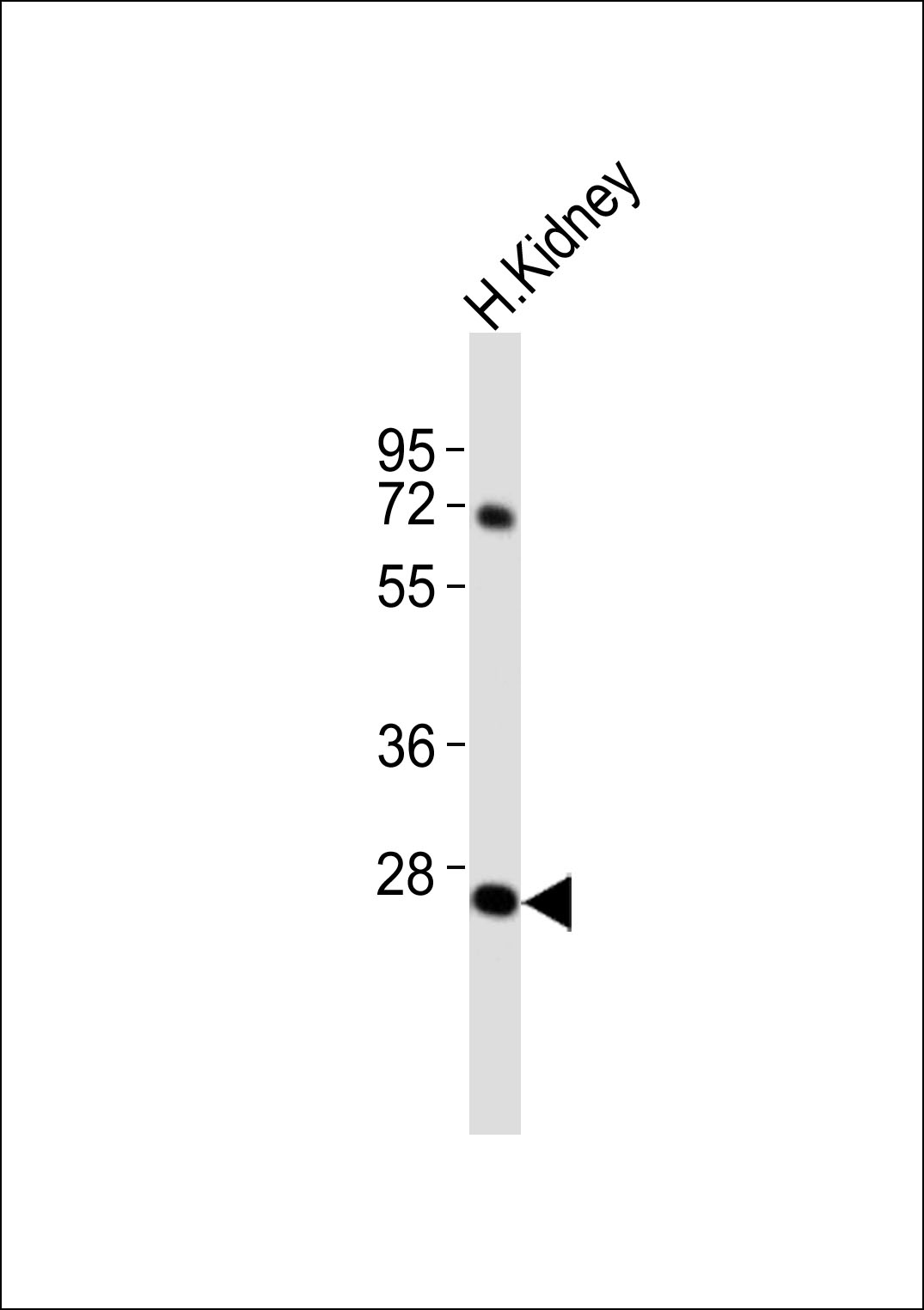 Anti-ABHD12B Antibody at 1:1000 dilution + human Kidney lysates Lysates/proteins at 20 µg per lane. Secondary Goat Anti-Rabbit IgG, (H+L),Peroxidase conjugated at 1/10000 dilution Predicted band size : 41 kDa Blocking/Dilution buffer: 5% NFDM/TBST.