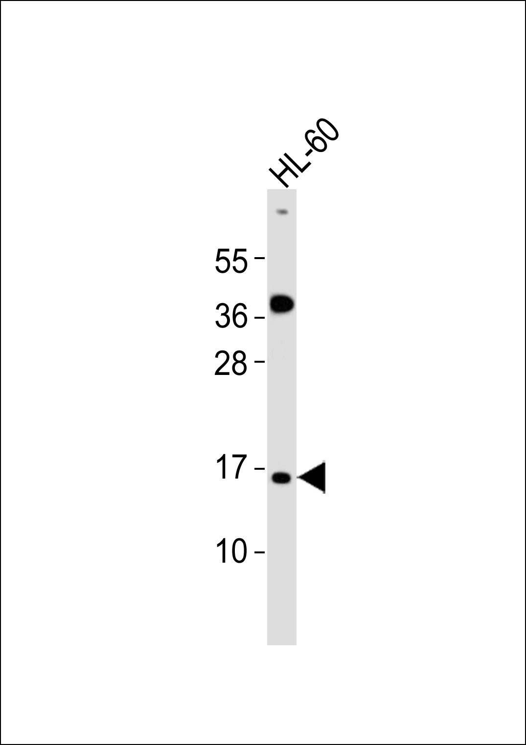Anti-ATP5JL Antibody at 1:1000 dilution + HL-60 whole cell lysates Lysates/proteins at 20 µg per lane. Secondary Goat Anti-Rabbit IgG, (H+L),Peroxidase conjugated at 1/10000 dilution Predicted band size : 11 kDa Blocking/Dilution buffer: 5% NFDM/TBST.