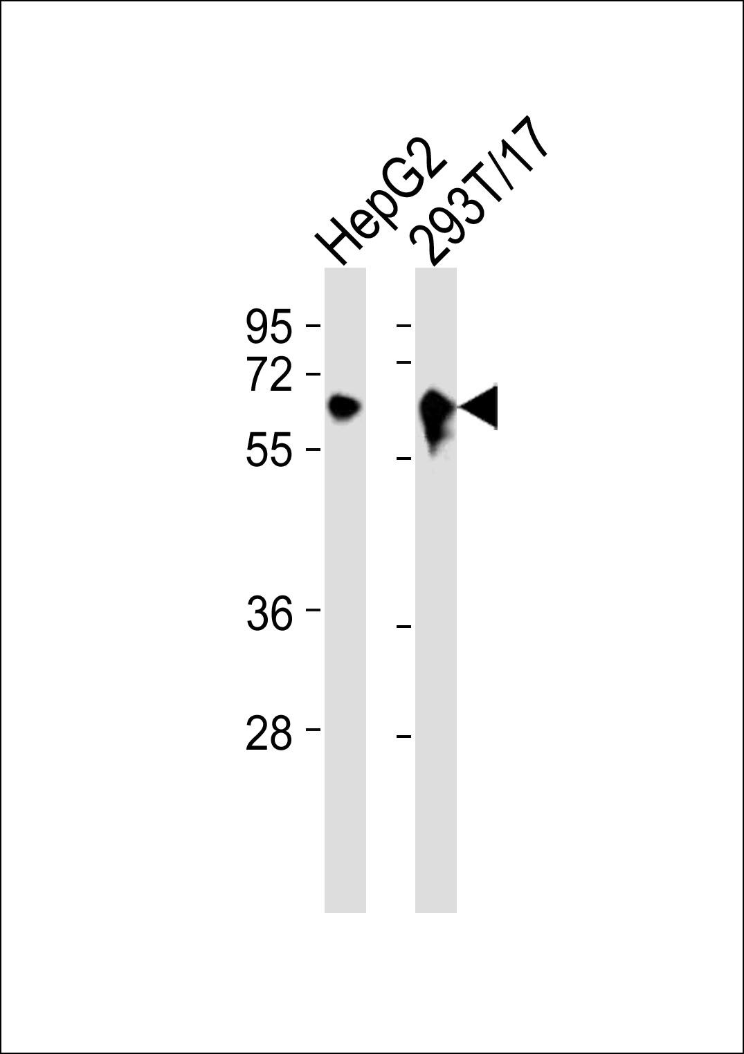All lanes : Anti-Arylsulfatase E Antibody at 1:1000 dilution Lane 1: HepG2 whole cell lysates Lane 2: 293T/17 whole cell lysates Lysates/proteins at 20 µg per lane. Secondary Goat Anti-Rabbit IgG, (H+L),Peroxidase conjugated at 1/10000 dilution Predicted band size : 66 kDa Blocking/Dilution buffer: 5% NFDM/TBST.