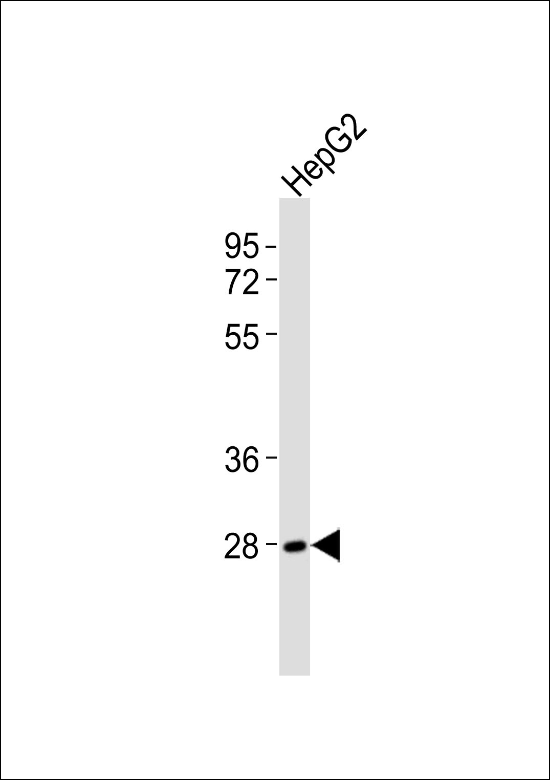 Anti-NAP1 Antibody at 1:1000 dilution + HepG2 whole cell lysates Lysates/proteins at 20 µg per lane. Secondary Goat Anti-Rabbit IgG, (H+L),Peroxidase conjugated at 1/10000 dilution Predicted band size : 45 kDa Blocking/Dilution buffer: 5% NFDM/TBST.