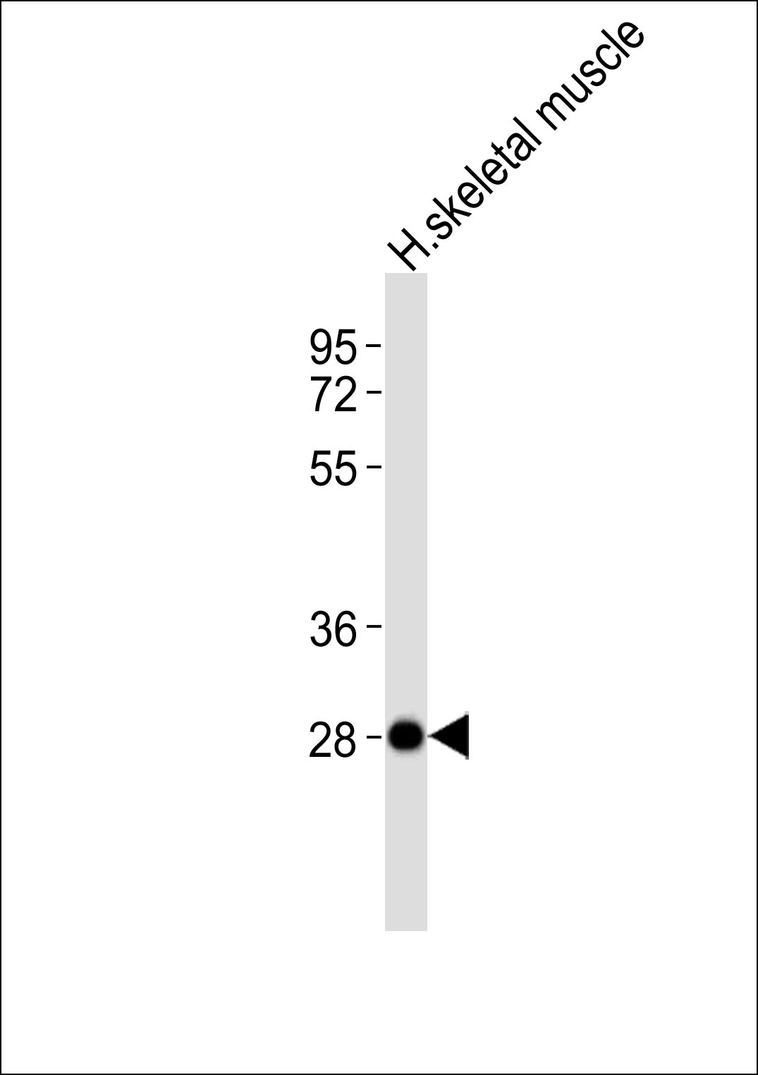Anti-NEURL2 Antibody at 1:1000 dilution + human skeletal muscle lysates Lysates/proteins at 20 µg per lane. Secondary Goat Anti-Rabbit IgG, (H+L),Peroxidase conjugated at 1/10000 dilution Predicted band size : 32 kDa Blocking/Dilution buffer: 5% NFDM/TBST.